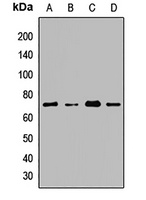 Anti-CDY1 Antibody