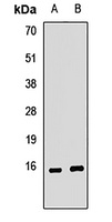 Anti-KCNE2 Antibody
