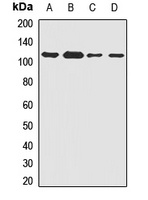 Anti-SAK Antibody