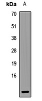 Anti-UQCRQ Antibody