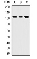 ROBO4 antibody