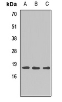 Anti-DNA Polymerase epsilon 4 Antibody