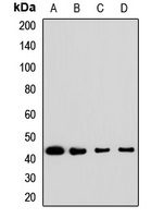 Anti-AMT Antibody