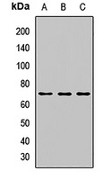 Anti-SOCS6 Antibody