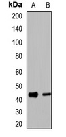 UBE2Q2 antibody