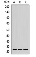 Anti-MYL6B Antibody