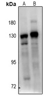 BUB1B antibody