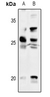Anti-Thymidine Kinase 1 Antibody