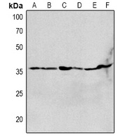 Anti-CHRNA1 Antibody