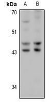 HSD17B2 antibody