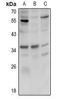 FOLR2 antibody