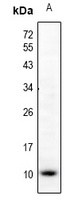 CCL5 antibody