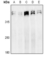 Anti-Ki67 Antibody