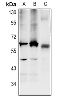 LPCAT2 antibody