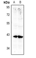 Anti-Annexin A10 Antibody