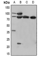 CTNNB1 (phospho-Y670) antibody