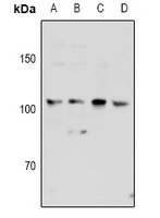 Anti-KSR2 Antibody