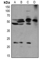 Anti-BLK (Phospho-Y389) Antibody