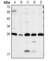 CAV2 antibody