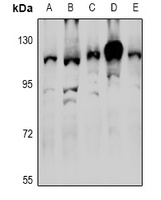 Anti-RNF111 Antibody