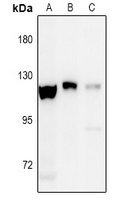 Anti-EPHA8 (Phospho-Y838) Antibody