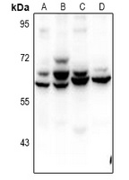 Anti-ZNF498 Antibody