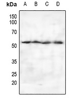 Anti-PSO Antibody