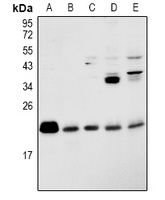 RAP2B antibody