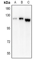 Anti-EPHA8 Antibody