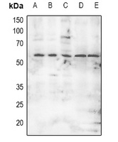 MKNK2 (phospho-T249) antibody