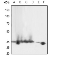 Anti-LAT (Phospho-Y161) Antibody