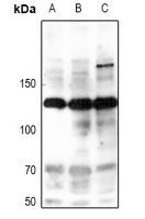 Anti-iNOS (Phospho-Y151) Antibody