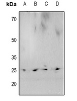 Anti-HP1 alpha (Phospho-S92) Antibody