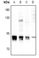 PRKCA (phospho-S657) antibody