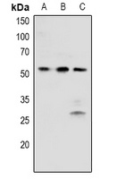 PTK6 (phospho-Y342) antibody