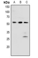 Anti-BRK (Phospho-Y342) Antibody