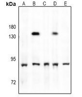 Anti-TBK1 (Phospho-S172) Antibody