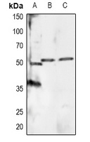 Anti-RXR alpha (Phospho-S260) Antibody