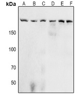 ACIN1 (phospho-S1180) antibody