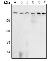 Anti-Acinus (Phospho-S1180) Antibody