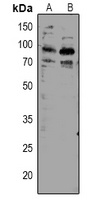 Anti-TORC2 (Phospho-S171) Antibody