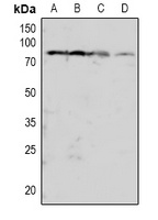 PRKCB (phospho-T641) antibody
