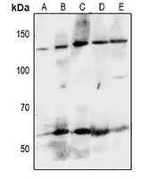 Anti-EPHA8 Antibody