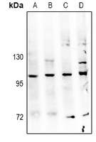 Anti-TBK1 Antibody