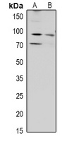 Anti-ZAK Antibody