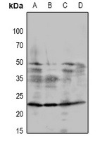 RCAN1 antibody