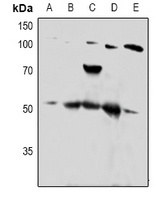 Anti-PTP1B Antibody
