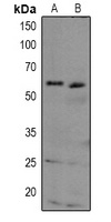 TAB1 antibody