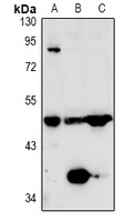 Anti-TAFI Antibody