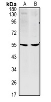 Anti-CCDC102A Antibody